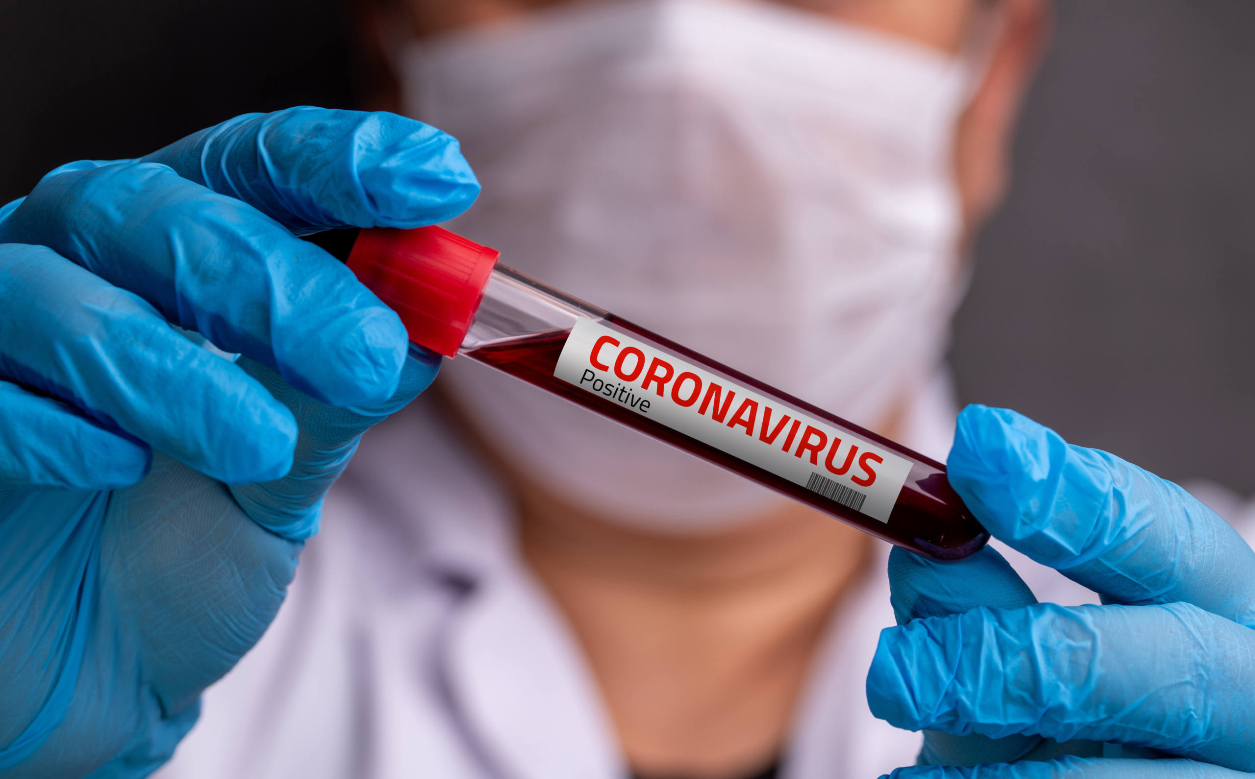 Coronavirus, è allarme edilizia: paralisi per il 95% delle imprese -  Notizie Attualità - CentroPagina - Cronaca e attualità dalle Marche